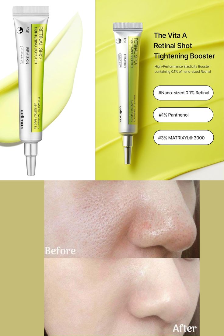 BUY 1 GET 1 FREE Celimax The Vita-A Retinal Shot for Wrinkles & Glow