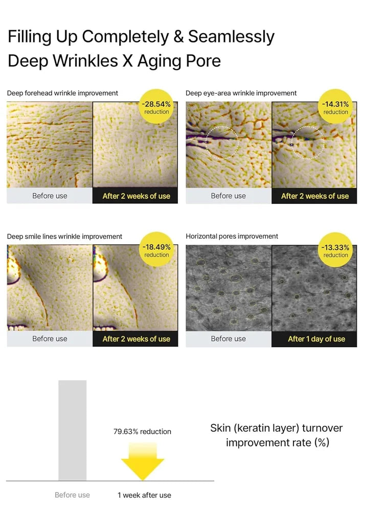 BUY 1 GET 1 FREE Celimax The Vita-A Retinal Shot for Wrinkles & Glow